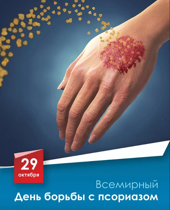 29 октября – Всемирный день борьбы с псориазом